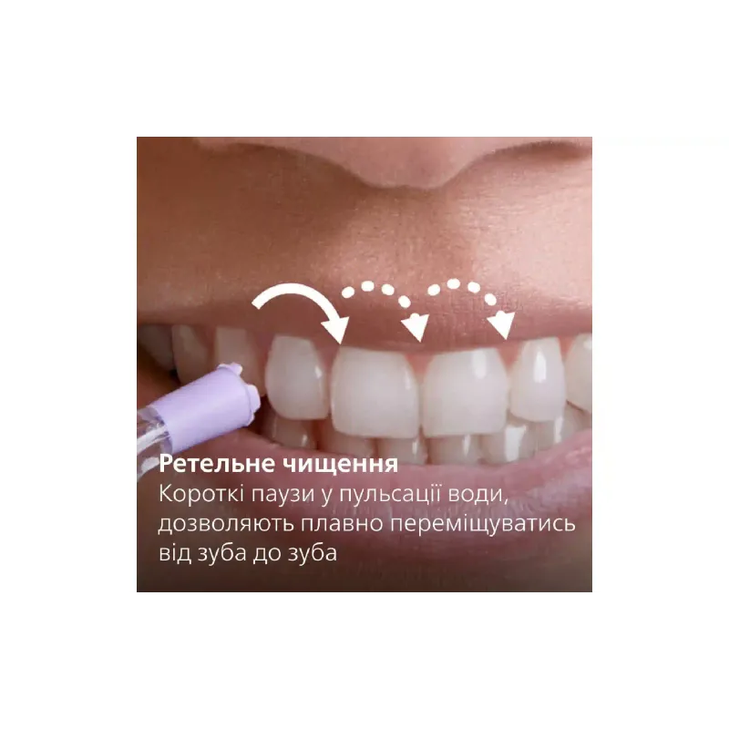 الري Philips (HX3911/40)